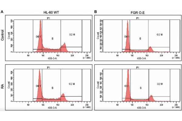 Single Protein Mirrors Retinoic Acid Treatment, Promoting Maturation in Leukemia Cells