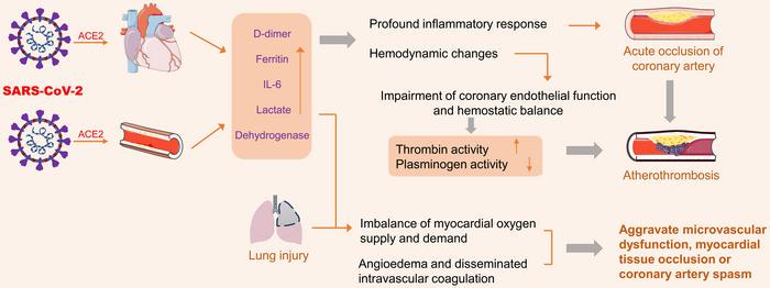 COVID-19 invades the body through a large number of ACE2 receptors in the heart and blood vessels, affecting cytokine levels and triggering an inflammatory response