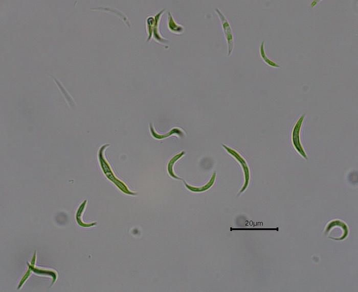Microalgae remove antibiotic residues from wastewater, reducing environmental contamination