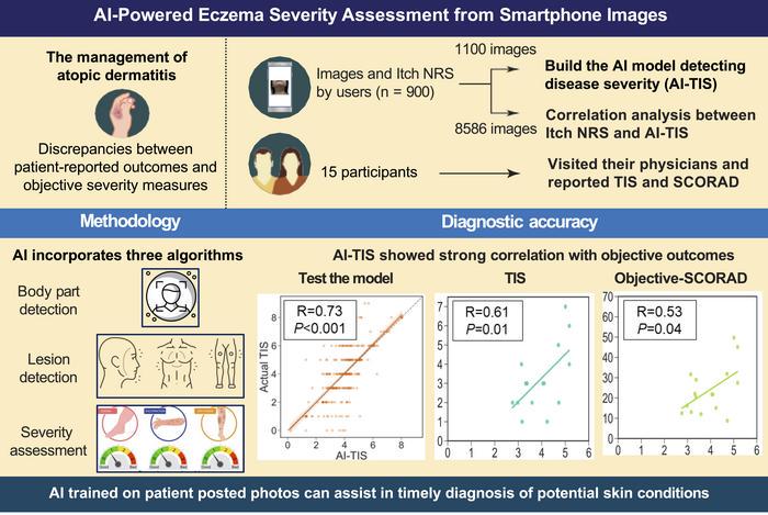 AI-Powered Eczema Severity Assessment from Smartphone Images