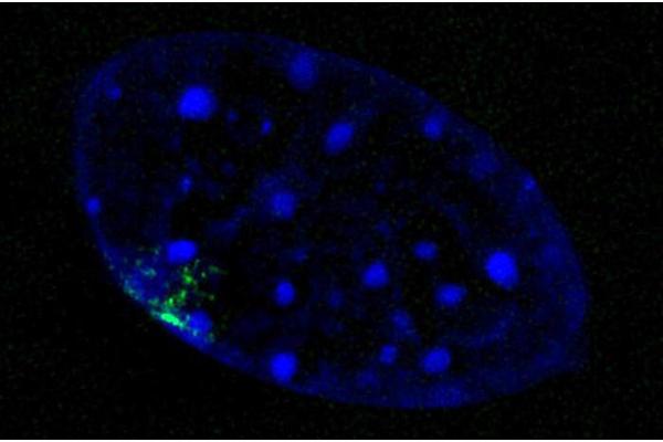 Silent X Chromosome Activates with Age: Uncovering New Insights into Sex Differences in Age-Related Diseases
