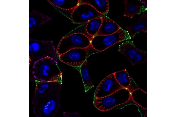 JAK1/2 Inhibition Fights MPNs Without Blocking Oncogenes
