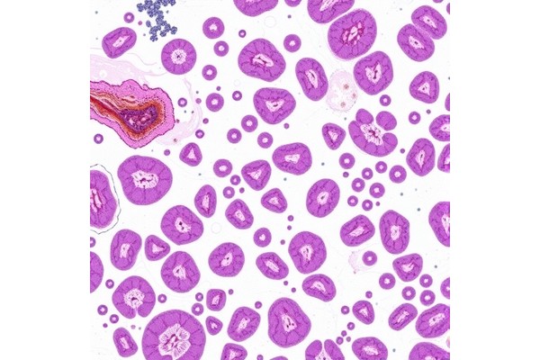 HistoGPT Transforms Gigapixel Dermatopathology Report Generation
