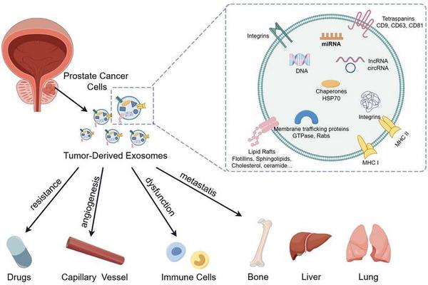 Exosomes: Emerging Biomarkers Revolutionizing Liquid Biopsy in Prostate Cancer