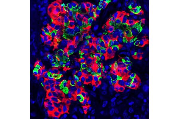 From Overlooked Organ to Vital Lifesaver: Unveiling the Spleen’s Secret Role as a Natural Bioreactor