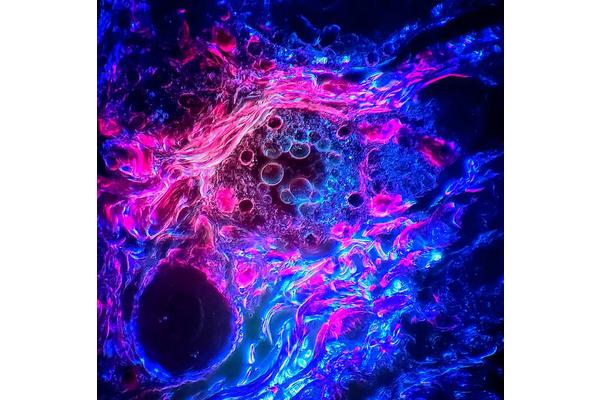 Sriram Gubbi of NIDDK Captures Top Honors in Endocrine Society’s 2025 Endocrine Images Art Competition