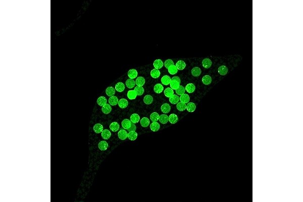 NNMT/1-MNA Shields Liver via AKT/FOXO1 Pathway