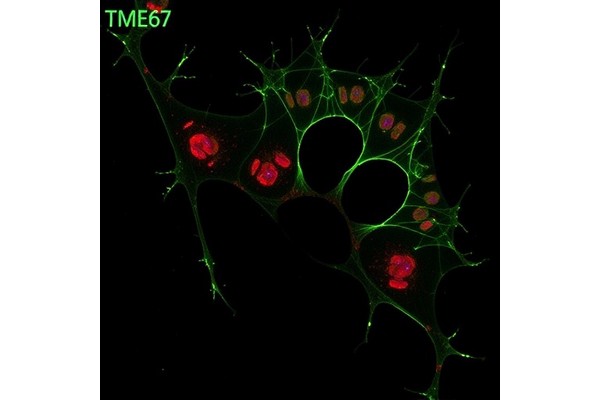 ADAMTS9 Cleaves TMEM67, Disrupting Wnt and Cilia