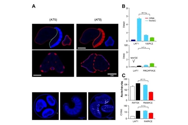 Fucosyltransferase 11 Inhibits Ferroptosis in Gastric Cancer