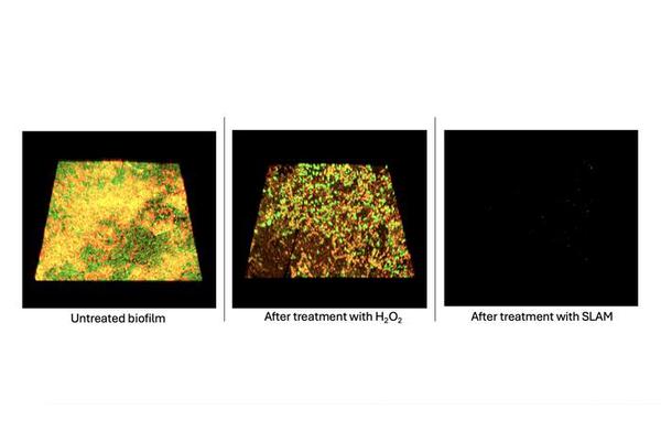 Two-Step Approach to Halting Biofilm Regrowth: A Game-Changer in Science!