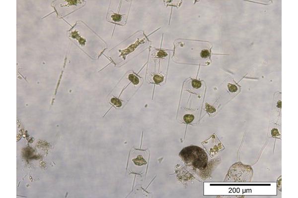 Coastal Plankton Threatened by Rising Marine Heatwaves