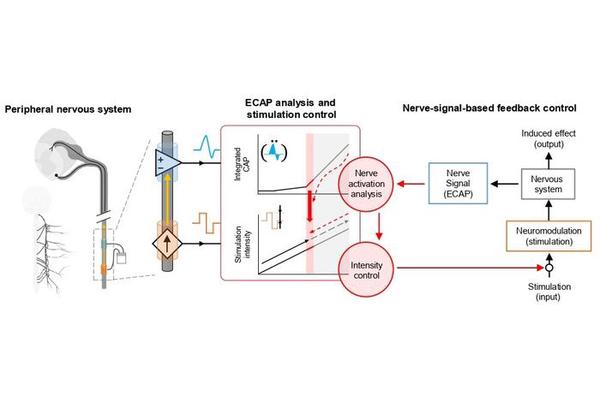 “Direct Nerve Monitoring Enables Personalized Tibial Nerve Stimulation for Urinary Disorder Treatment”