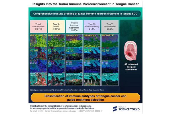 Mapping the Immune Landscape of Tongue Cancer: A New Frontier in Oncology