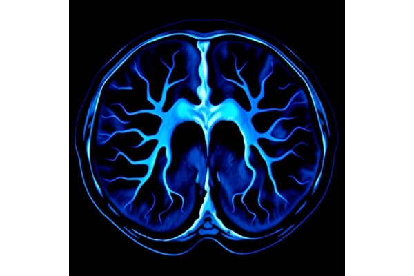 Deep Learning Boosts Prostate Cancer Imaging Quality