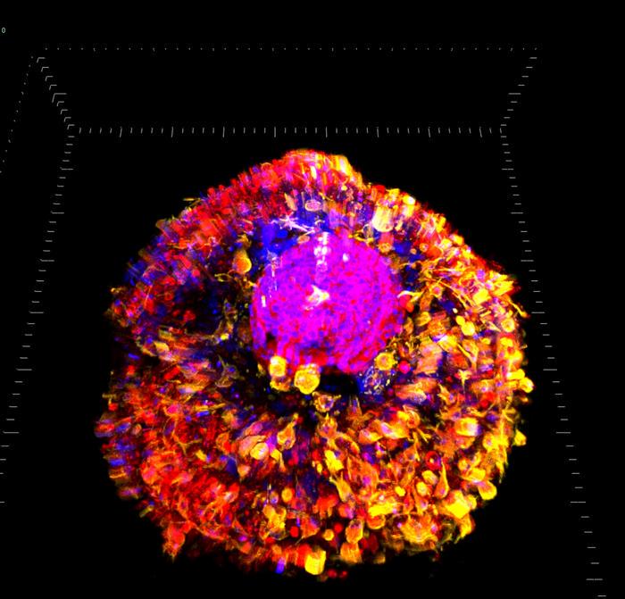 3D reconstructions of hepatocyte and fibroblast shielded islets (HFI).