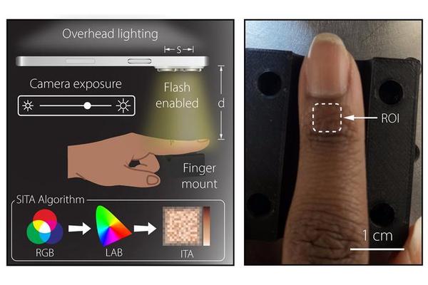 Smartphones Enhance Medical Device Accuracy Across Diverse Skin Tones