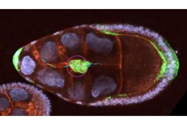 New Study Enhances Insights into Cell Migration, Paving the Way for Medical Breakthroughs