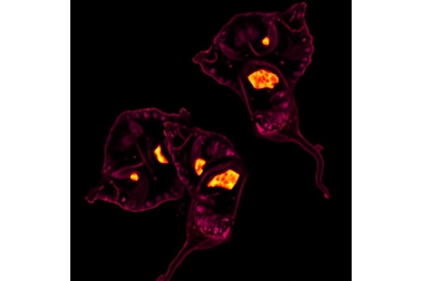 CYPD Restricts HR+ Breast Cancer in Mice