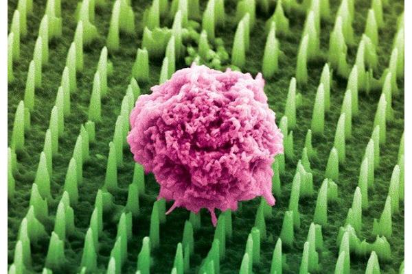Millions of Nanoneedles Poised to Replace Painful Cancer Biopsies