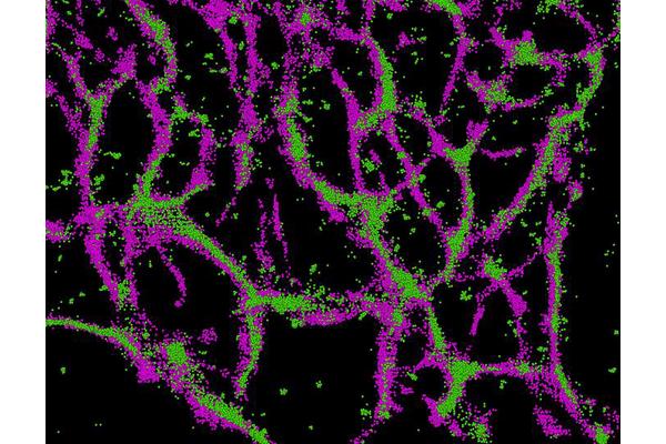 New Peptide Drug Shows Promise in Fighting Deadly Brain Cancer, Researchers Reveal