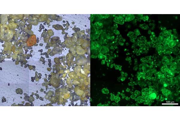 Tiny Anoxic Pockets Trigger Major Nitrogen Loss on Sandy Shores