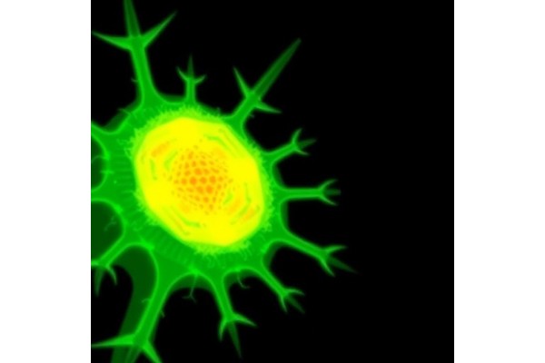 Thermosensor FUST1 Triggers Heat Stress Granules in Plants