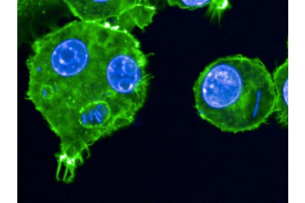 Plague Bacillus Reduced Virulence Extended Two Major Pandemics
