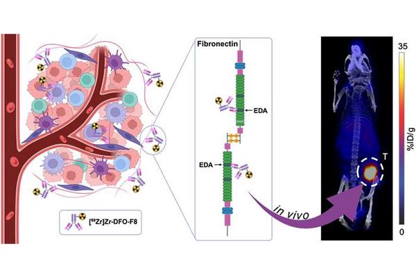 Innovative Imaging Technique Identifies Multiple Subtypes of Triple Negative Breast Cancer