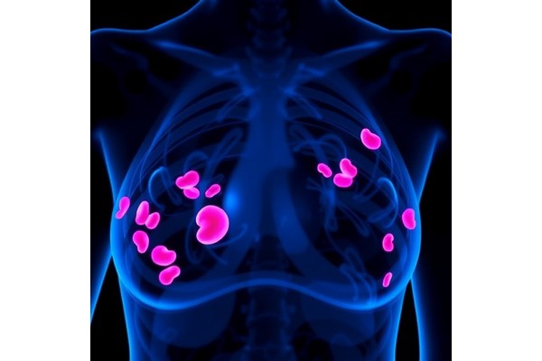 Targeting Trophoblast Antigen in Triple-Negative Breast Cancer