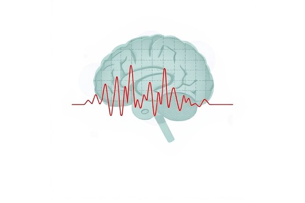 Reliable EEG Measures in Schizophrenia Research Protocol