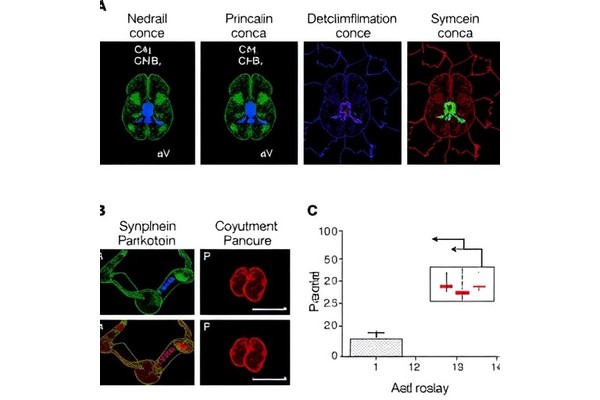 Complement C4 Drives Neuroinflammation and α-Synuclein in Parkinson’s