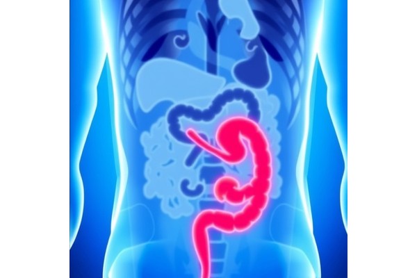 Colorectal Cancer Diagnosis: A Lifesaving Breakthrough or a New Threat for Patients with Multiple Cancers?