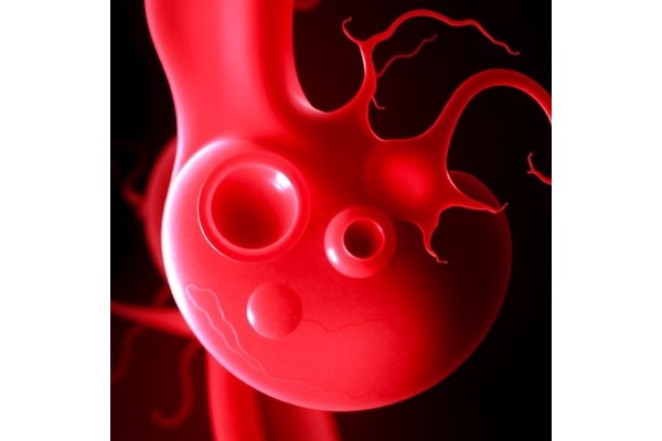 Placental Pathology: Unlocking Preterm Birth and Neurodevelopment Risks
