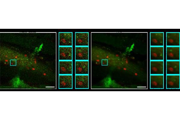Revolutionizing High-Speed Dynamic Fluorescence Imaging with Deep Learning-Enhanced Denoising Techniques