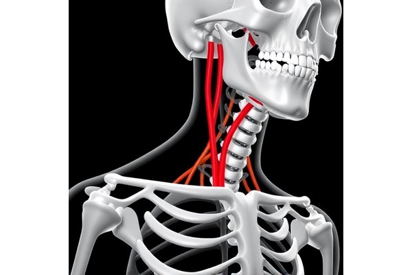 ELMO2 Crucial for Carotid Artery Development