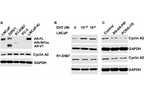 Disrupting PCNA-Androgen Receptor Interaction Inhibits Prostate Cancer Cell Growth
