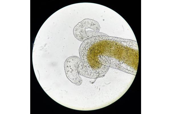 Heatwaves Significantly Increase Parasite Loads, Potentially Boosting Disease Spread