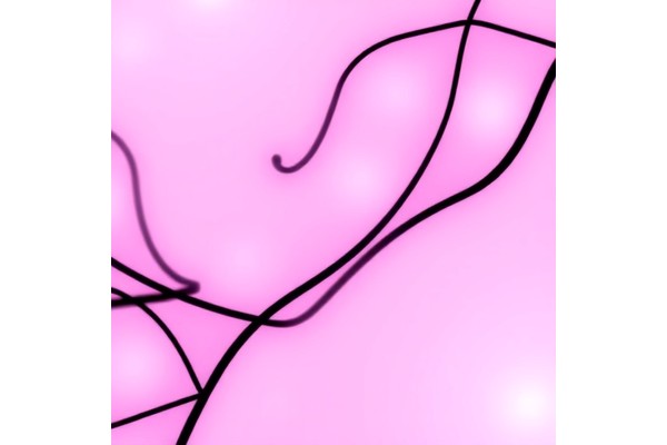 Emerging Advances and Future Prospects in Anal Cancer