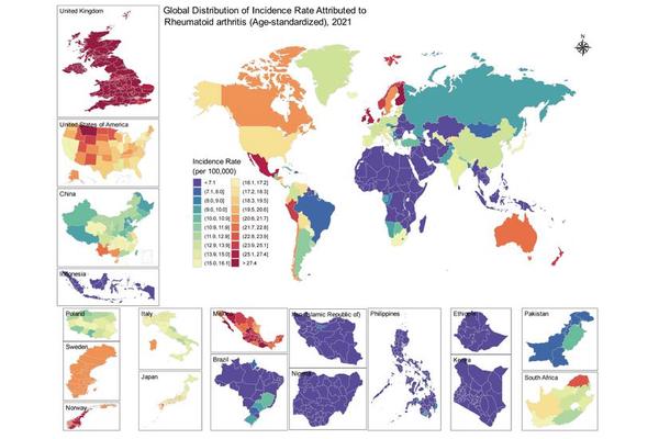 AI-Driven Analysis Uncovers Global Rise in Rheumatoid Arthritis Since 1980, Identifies Regional Hotspots