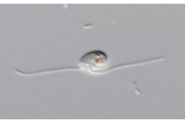 Rediscovering the Protist Glissandra: Unveiling Shared Traits of the Mysterious Crums Lineage