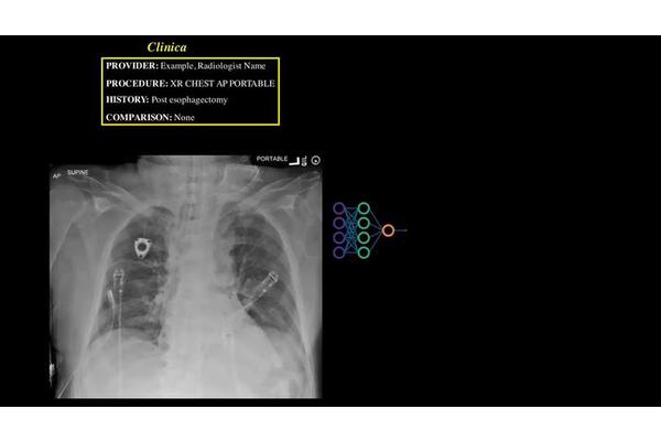 Revolutionary AI Enhances Radiology with Unprecedented Speed and Precision