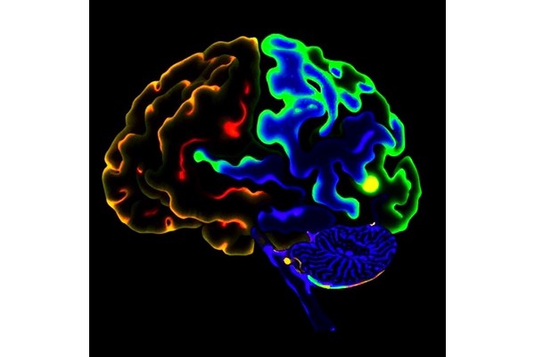 Dual PRMT5 and MAT2A Inhibition Kills MTAP-Deficient Gliomas