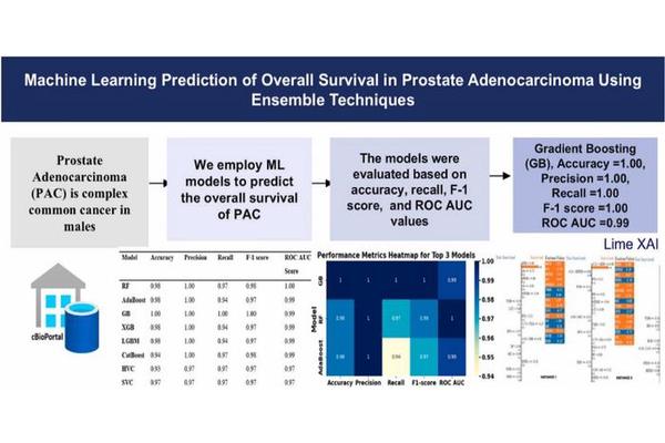 Researchers Create AI Technique to Forecast Prostate Cancer Patients’ Overall Survival Rates