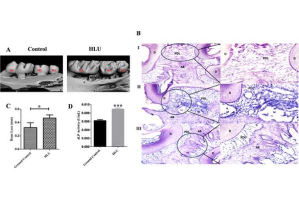 Scientists Reveal: Space Environment Linked to Gum Inflammation and Bone Loss