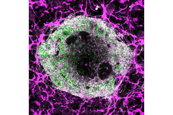 Breakthroughs in Organoid Development Promise to Accelerate Research and Drive New Treatments