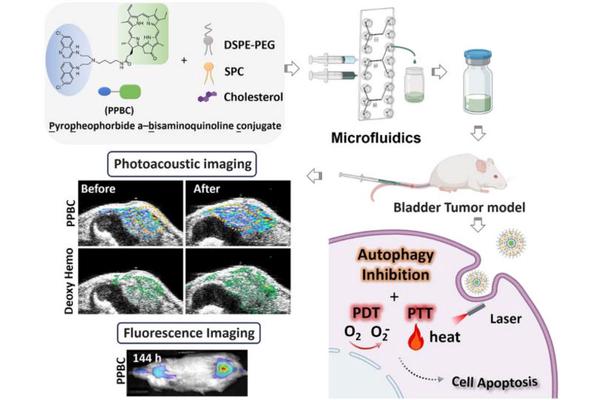Multifunctional Nanoparticles Enable Bimodal Image-Guided Phototherapy for Advanced Bladder Cancer Treatment